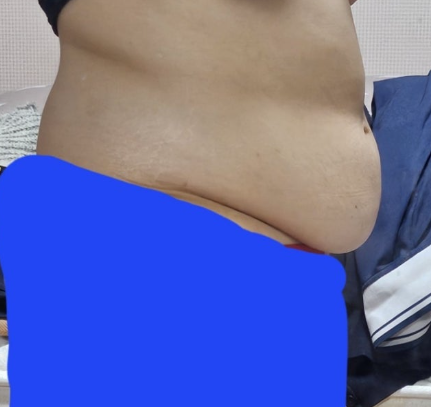 뷰앤디 슬렌웨이 내돈내산