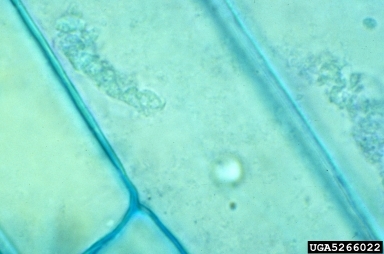 퓨로바이러스에 감염된 세포