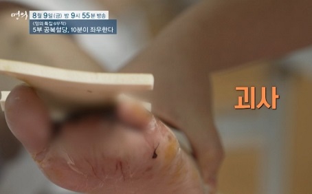 당뇨병합병증