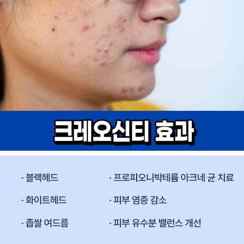 크레오신
