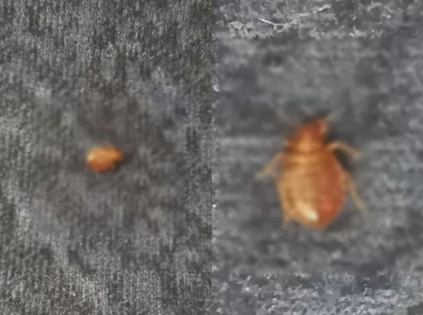 일본 SNS를 통해 공유된 일본 지하철 빈대 사진