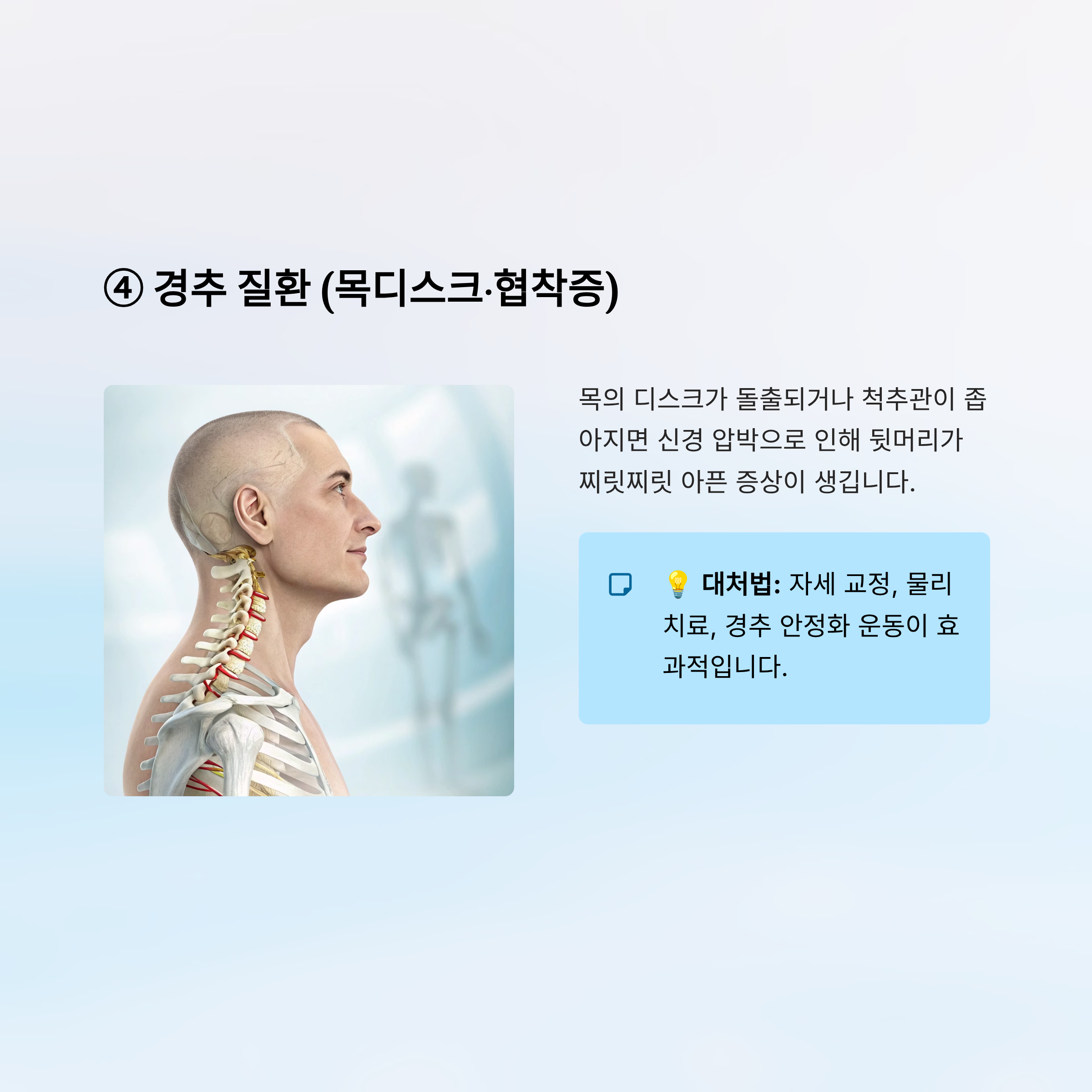 머리가 찌릿찌릿 아파요｜원인, 대처법, 병원 가야 할 때 완전 정리