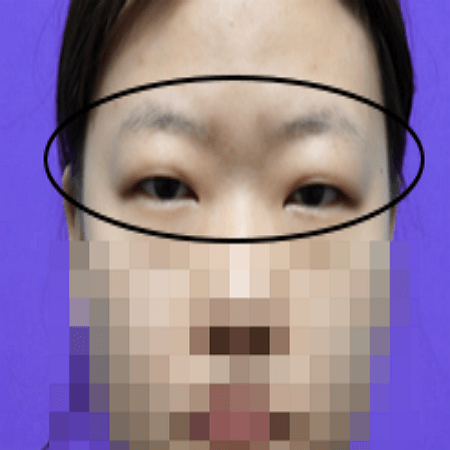 이마거상술 전 사진 예시