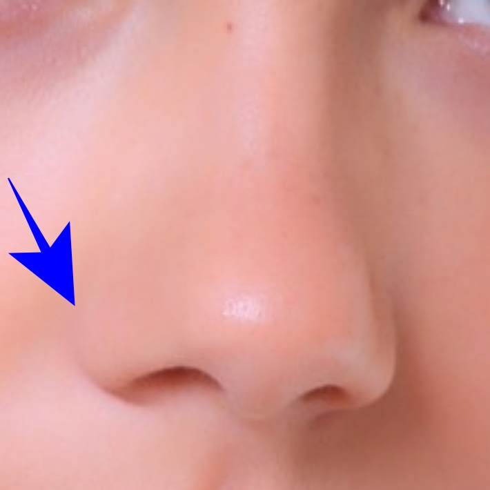 코볼 옆을 마사지 한다.