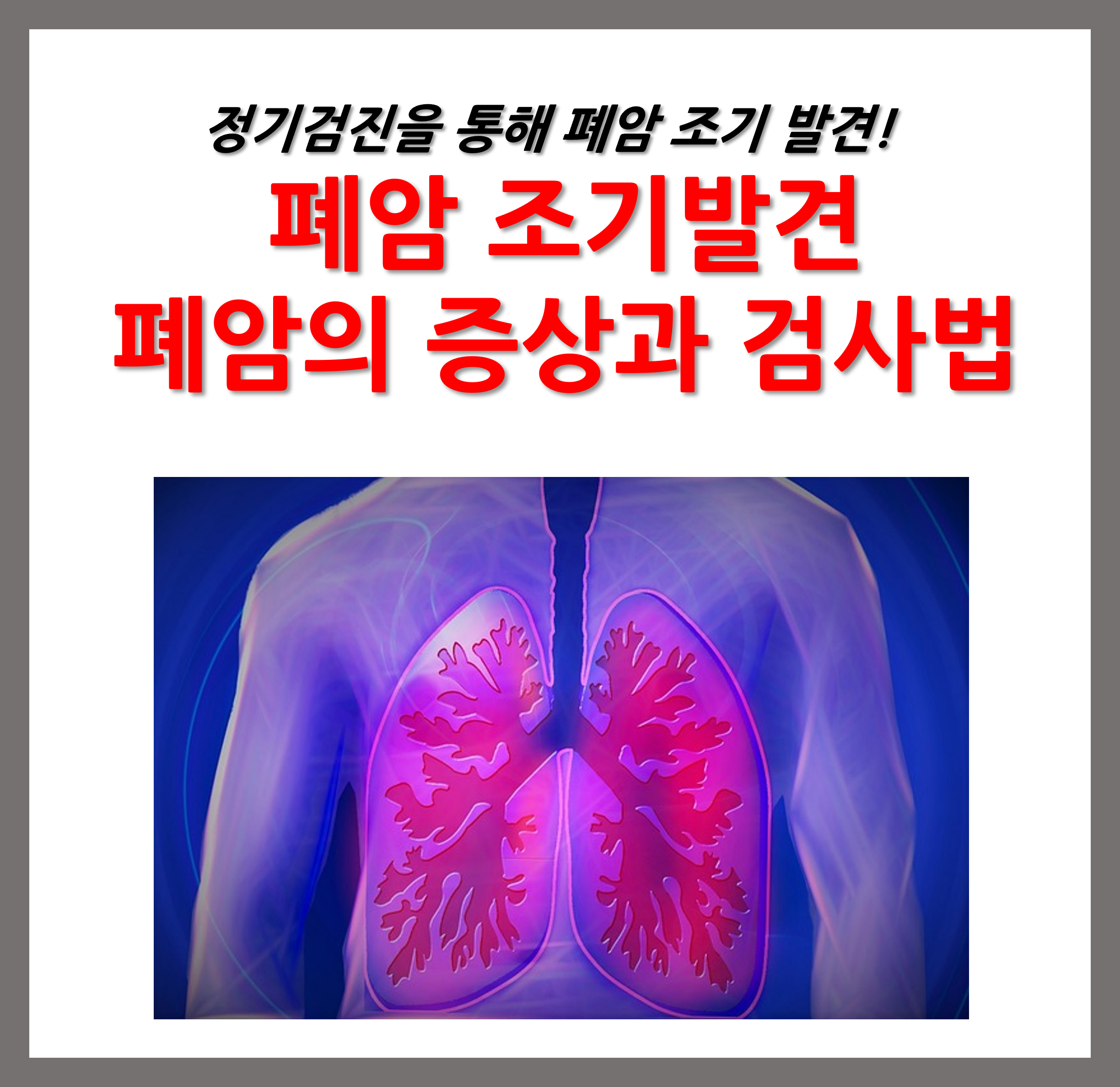 폐암 증상, 조기발견