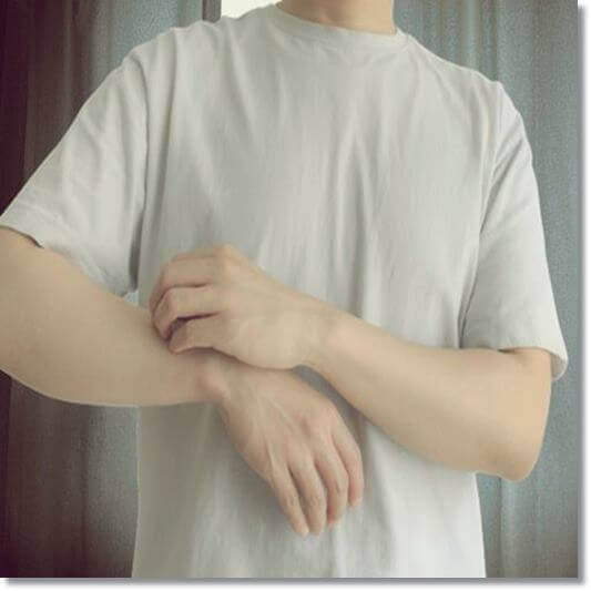 색소성 양진 증상 두드러기와 차이