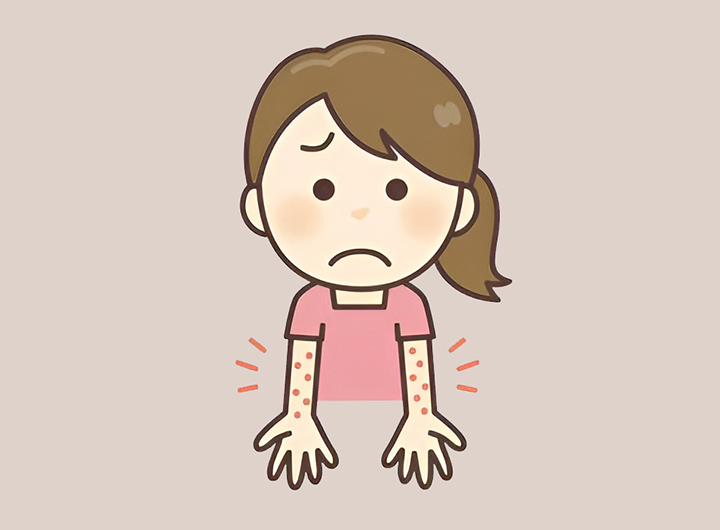 어린콜라겐으로-알레르기가-생긴-여성