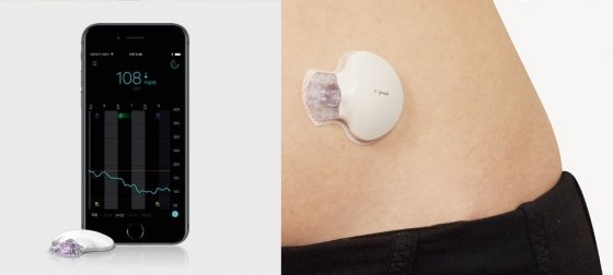 연속혈당측정기