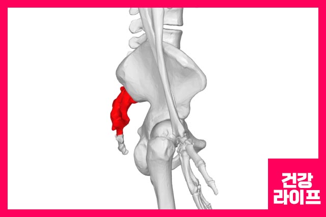 약물치료, 물리치료, 수술 등으로 치료할 수 있습니다.