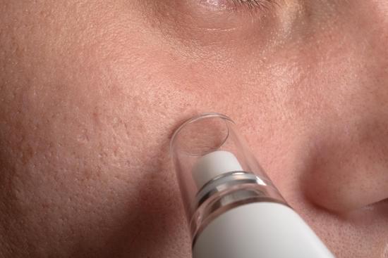 모공 관리를 통한 피부 관리: 모공 청소부터 피부 개선까지