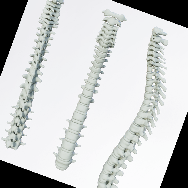 허리 삐끗했을때 찜질 방법