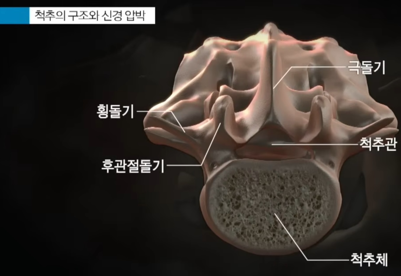 신경외과-진동규-교수