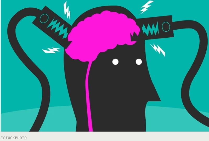 "뇌 자극, 노인의 기억력 향상에 도움" 보스턴 대 Brain Stimulation Improves Memory in Older Adults