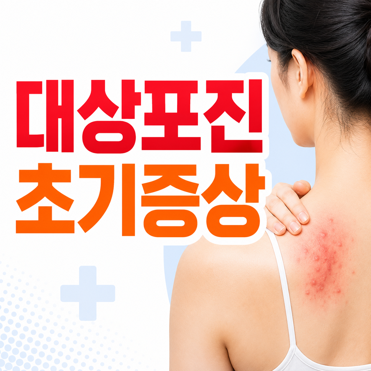 대상포진 초기증상