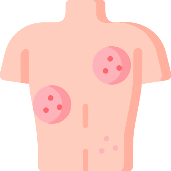 건선&amp;#44; 평생을 함께하는 만성 염증 질환