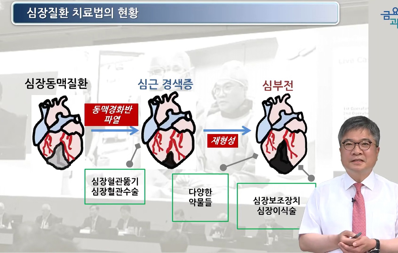 EBS명의-안영근-교수