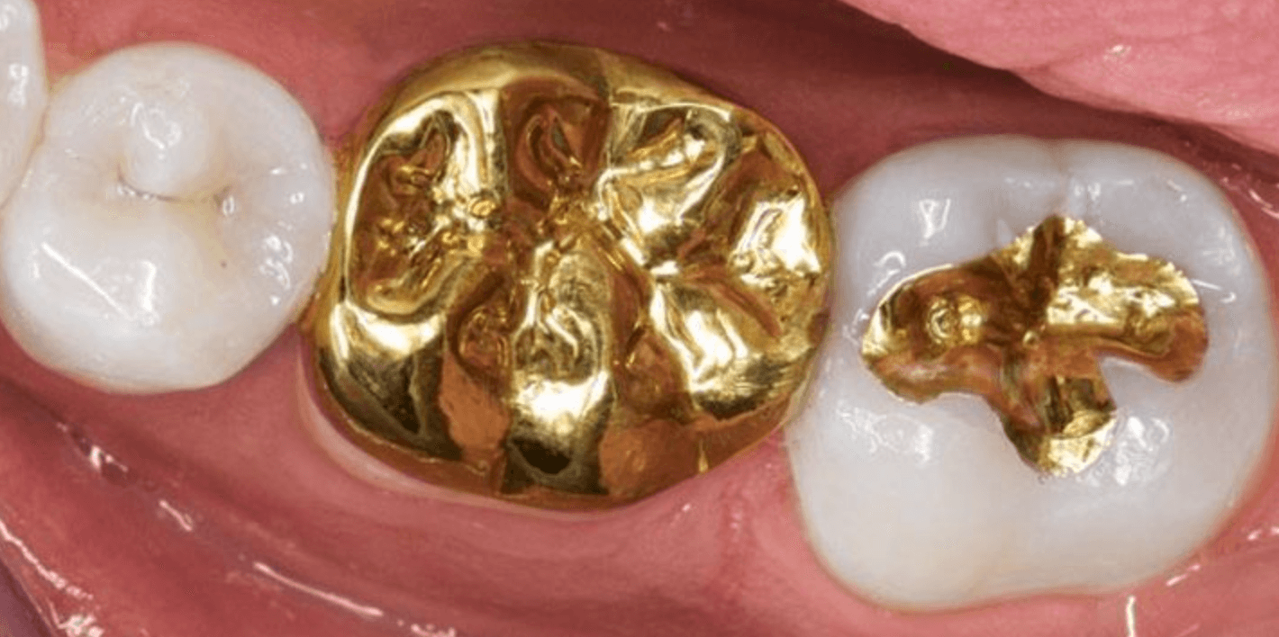 치아 통증 원인