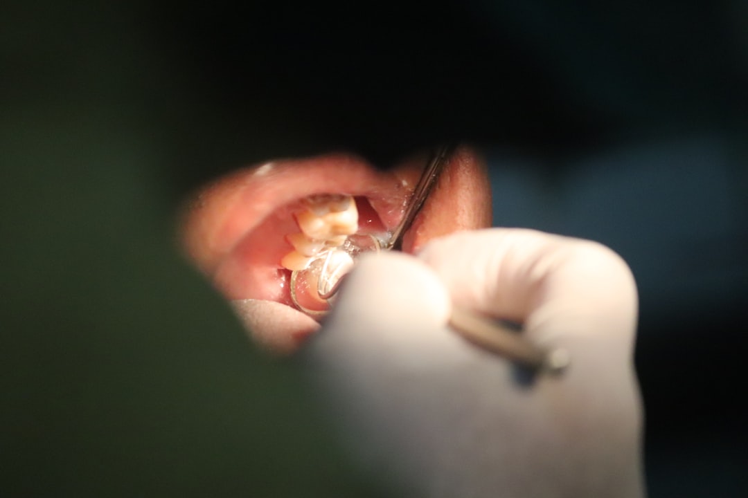 Implant
