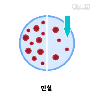 위축성 위염 진단 치료