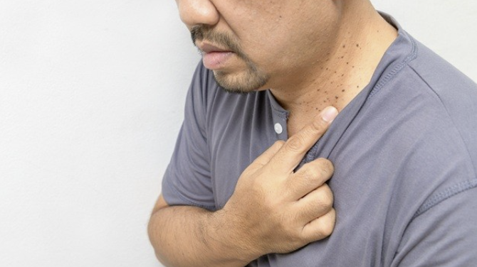 편평사마귀_사진