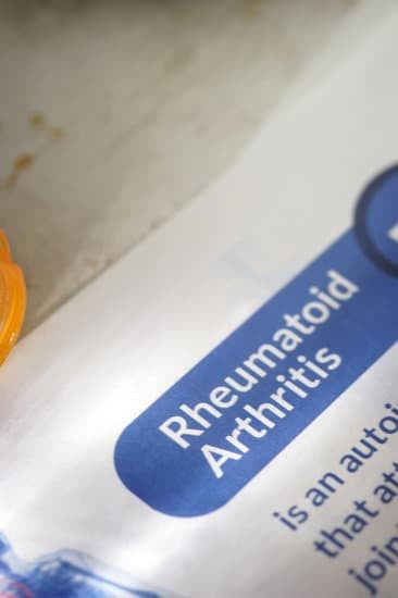 류마티스 관절염