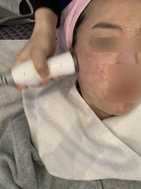 크라이오셀 후기