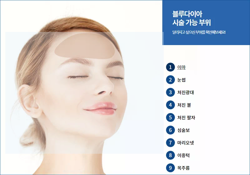 시술가능부위