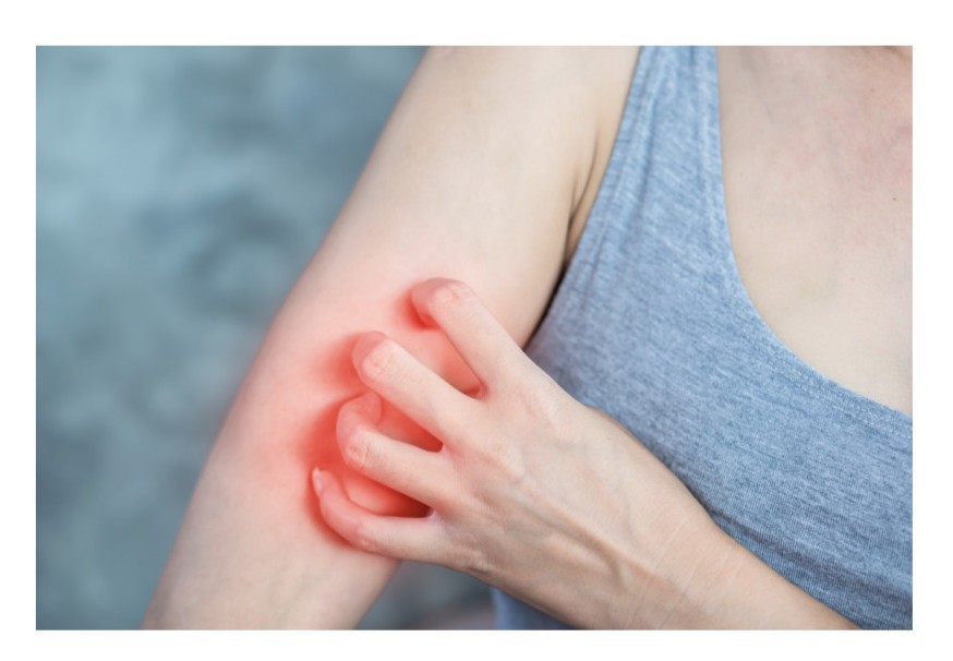 가려움증 이미지