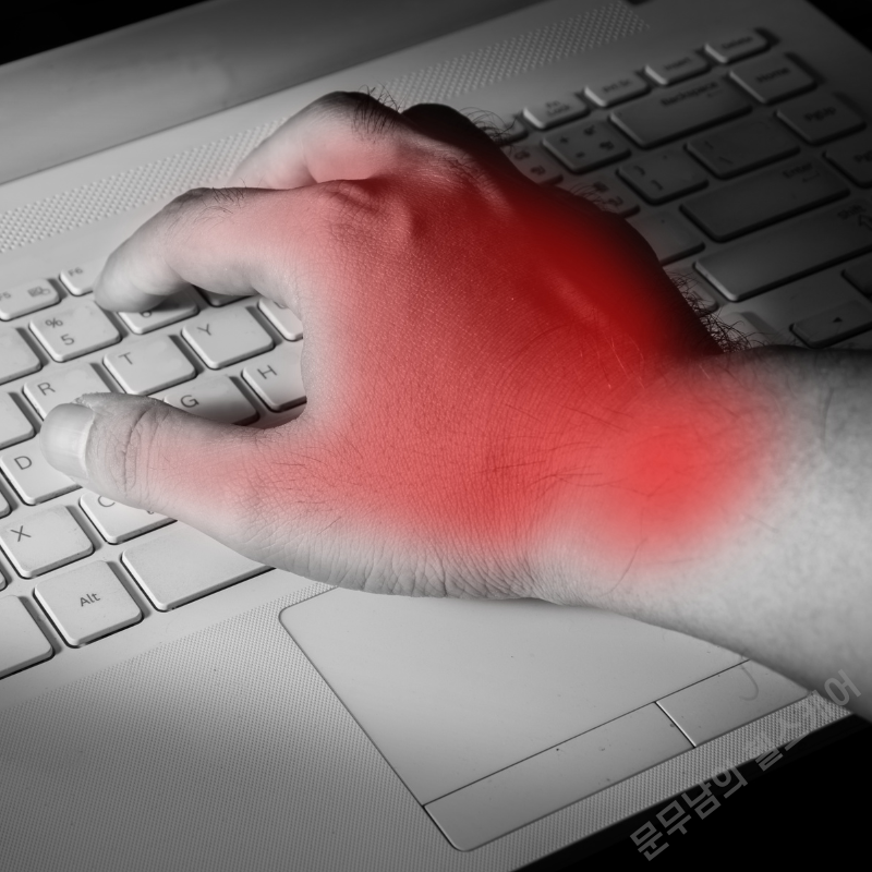 손목터널증후군