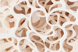 골다공증-치료방법