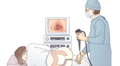 대장내시경이미지