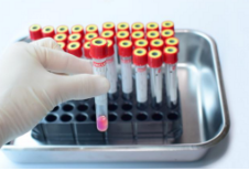 당화혈색소-사진9