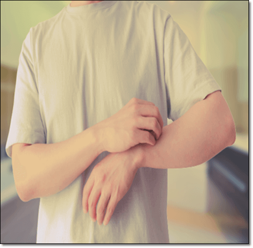 유당 불내증 및 우유알레르기