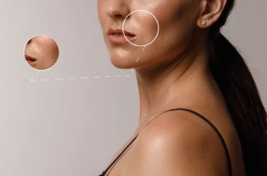 팔자주름 생기는 원인