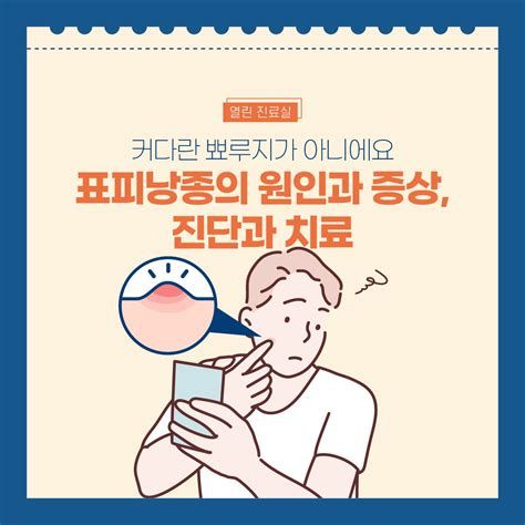 표피낭종 수술