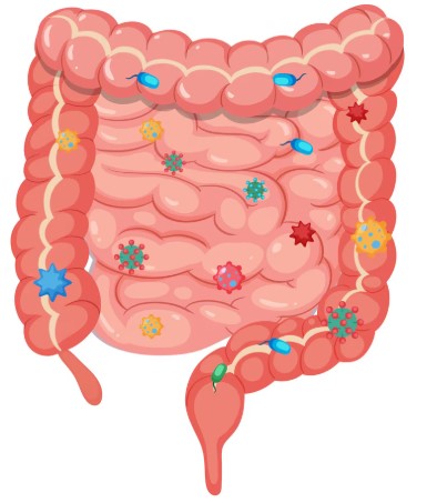 조기 발견이 생존율을 결정짓는 대장암