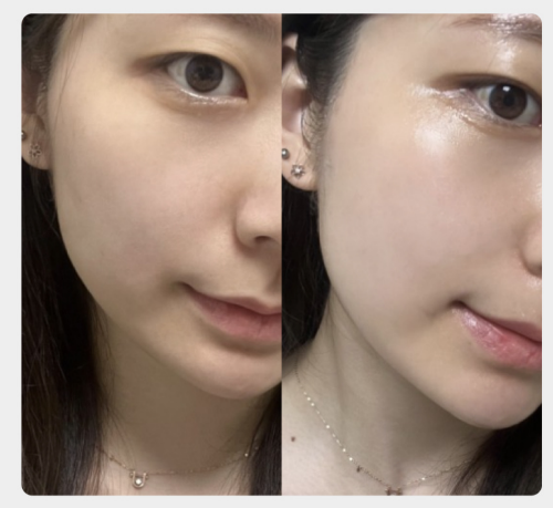 톰 프로그램(THOME) 후기