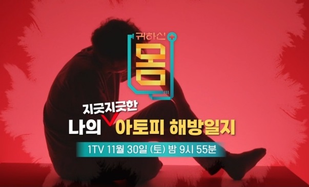 나의아토피해방일지