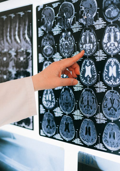 뇌동맥류-원인-증상