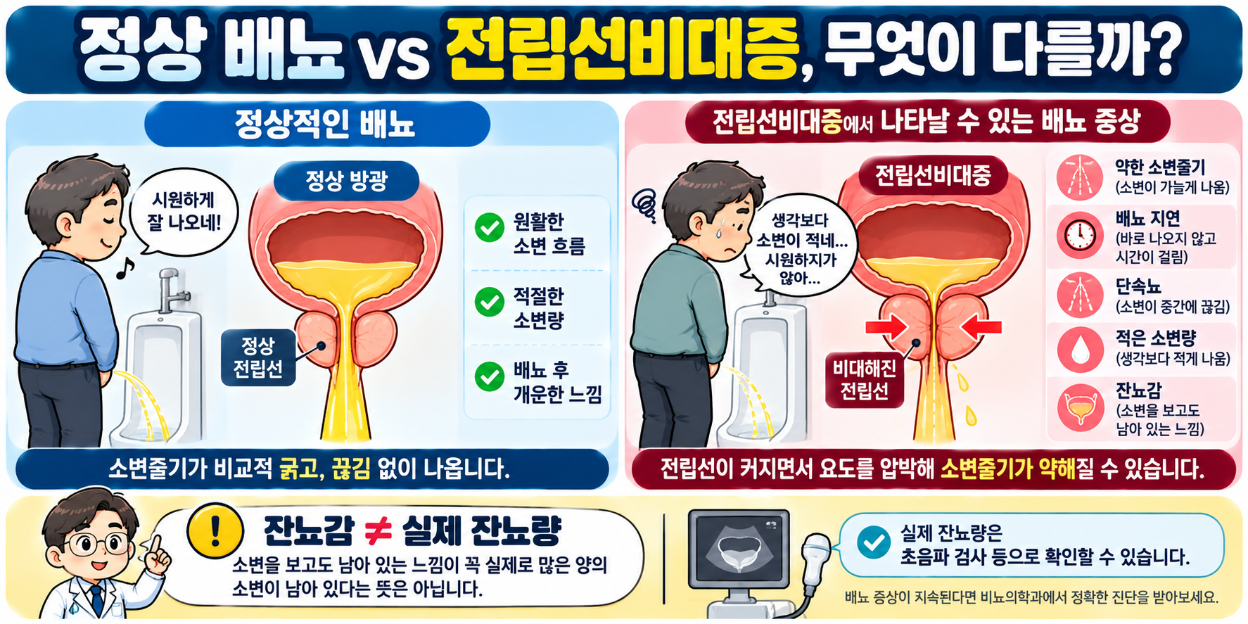 정상 배뇨와 전립선비대증의 약한 소변줄기 및 잔뇨감 차이