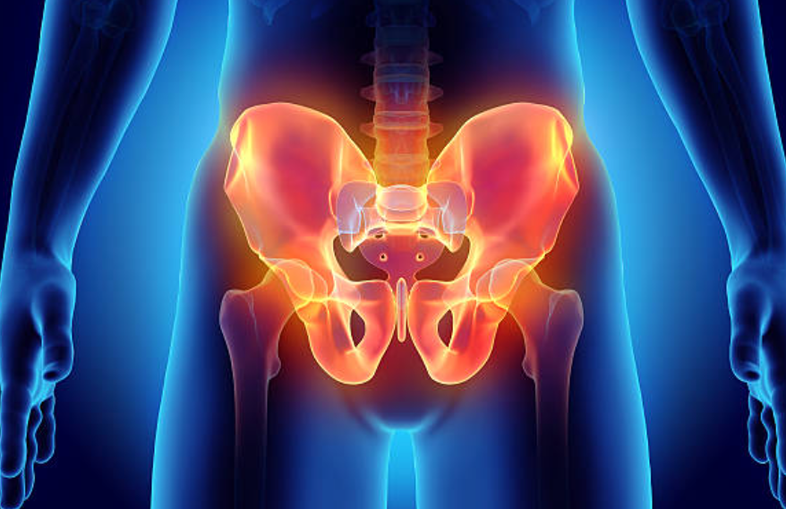 골반 통증 관련 사진