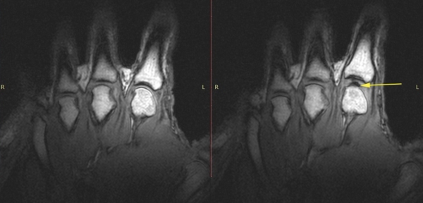 병원 MRI 기기 사진, 관절 소리 연구에 사용된 의학 영상