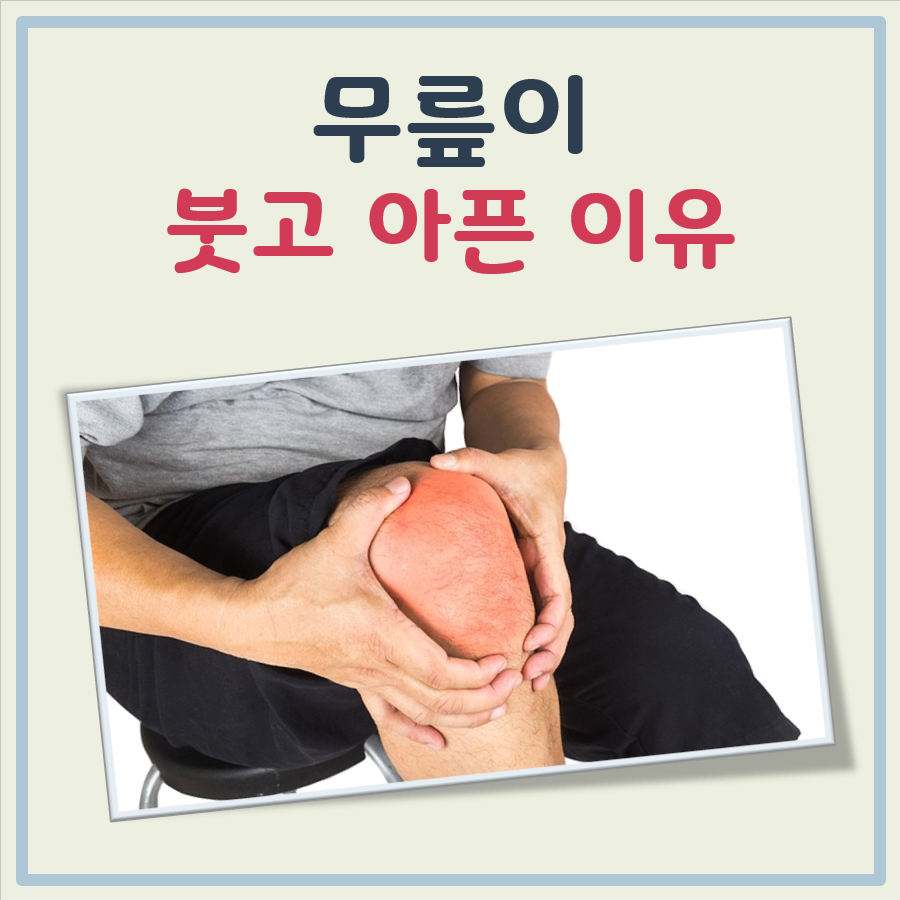 무릎이 붓고 아플 때 대표 이미지