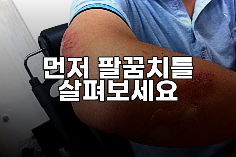 먼저 팔꿈치를 살펴보세요