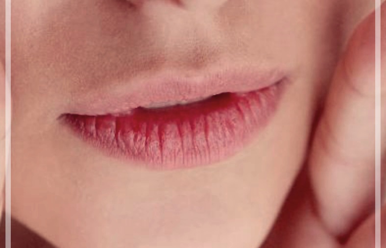 박탈성 구순염 완치 방법 3가지