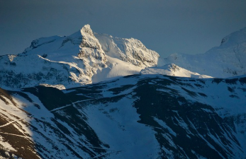 검버섯이 생기는 이유 총정리 12