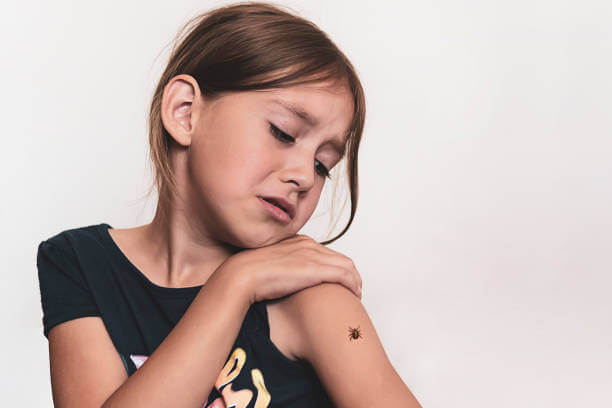 빈대 물린자국&amp;#44; 퇴치제&amp;#44; 예방법