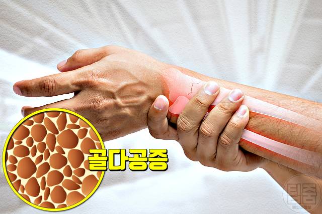 감식초 매일 먹으면 감식초효능 골다공증 감식초먹는법