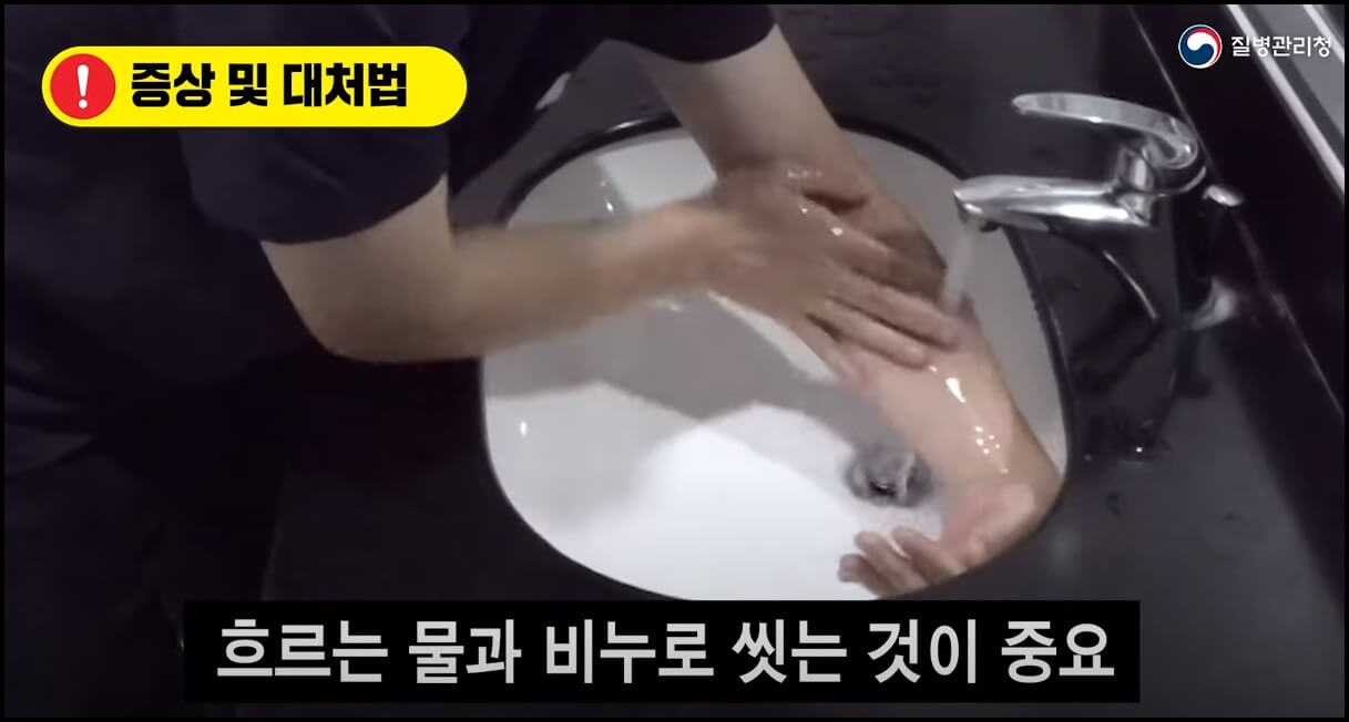 빈대에 물렸을 때는 깨끗히 씻어주세요.