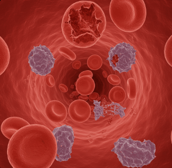 용혈 요독 증후군 초기증상 및 치료법3